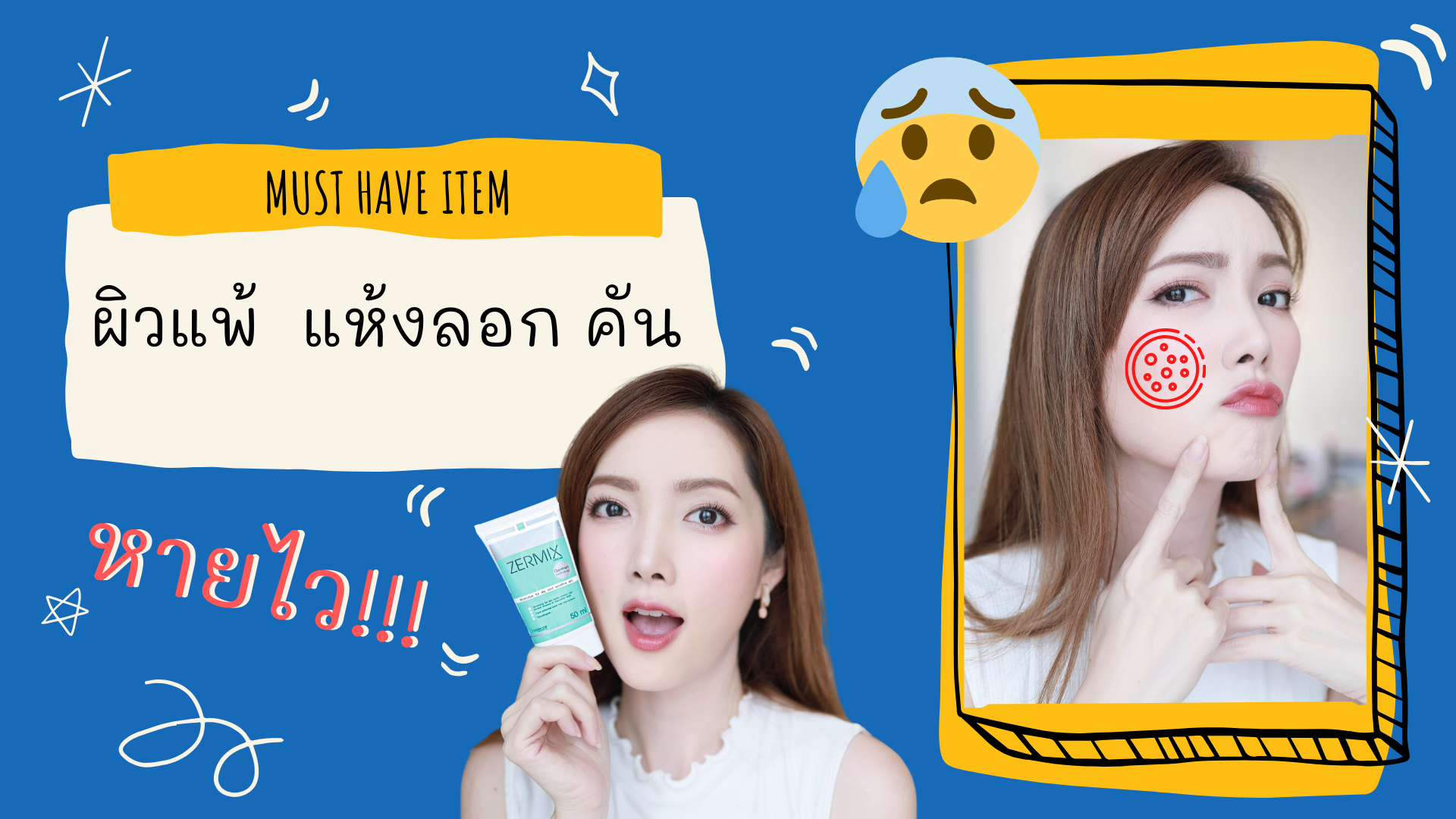 ครีมนี้ที่ต้องมีติดบ้าน รักษาผิวแพ้ คัน ลอก ผื่น ฉุกเฉินปุ๊ปทาปั๊ป! | ZERMIX